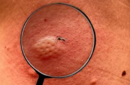 Boli transmise de țânțari / Profimedia Images