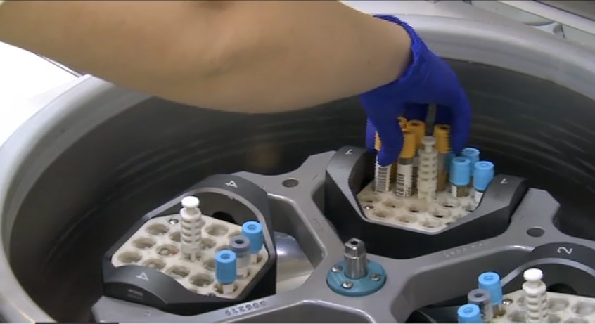 Prevenția infarctului începe din copilărie. Copiii trebuie testați pentru colesterol de la 9 ani