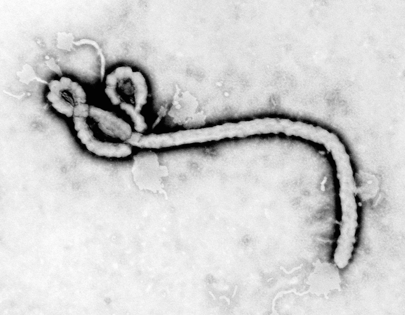 Noi speranțe în lupta împotriva Ebola: Cercetătorii dezvoltă