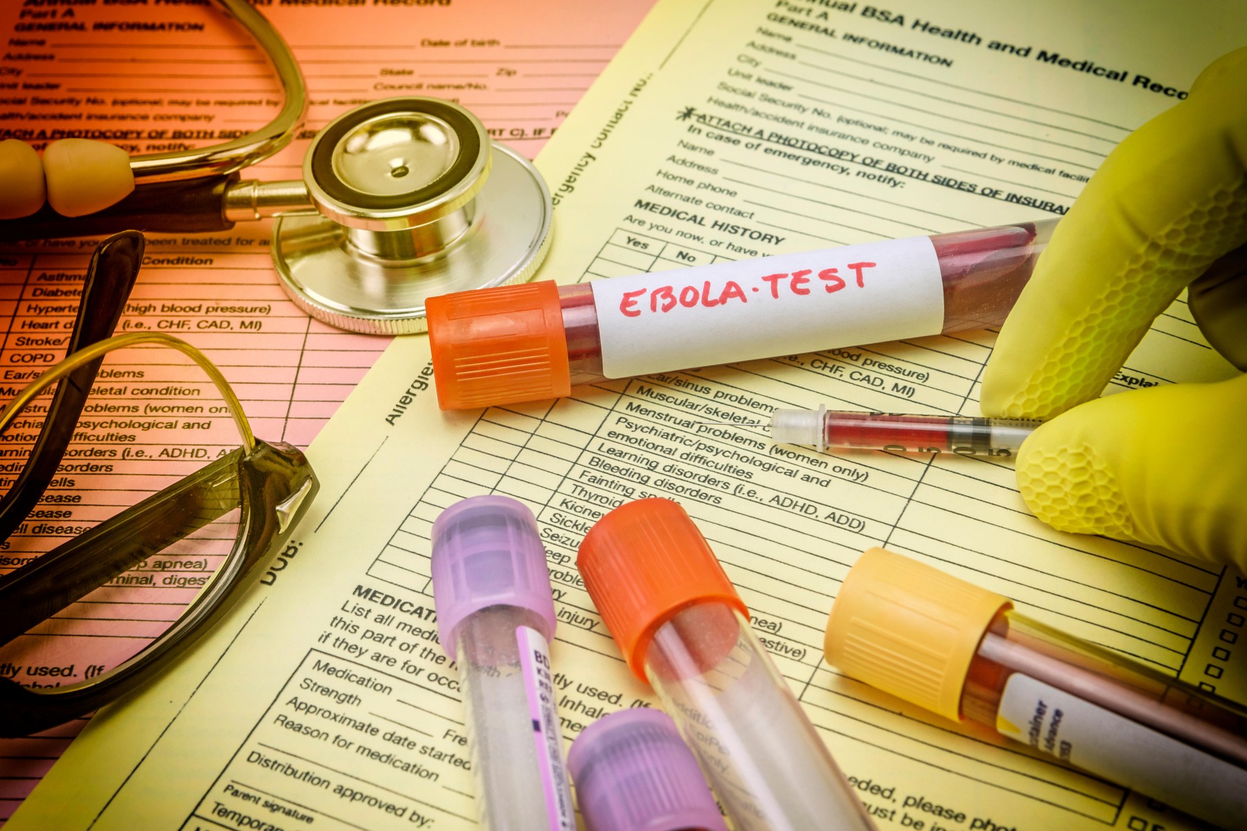 Pacient internat în Olanda cu suspiciune slabă de infectare cu virusul Ebola