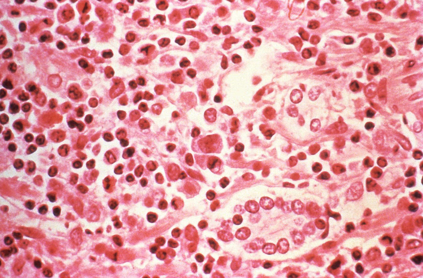 Dr. Adrian Marinescu, despre hantavirus: Nu există risc de epidemie sau pandemie