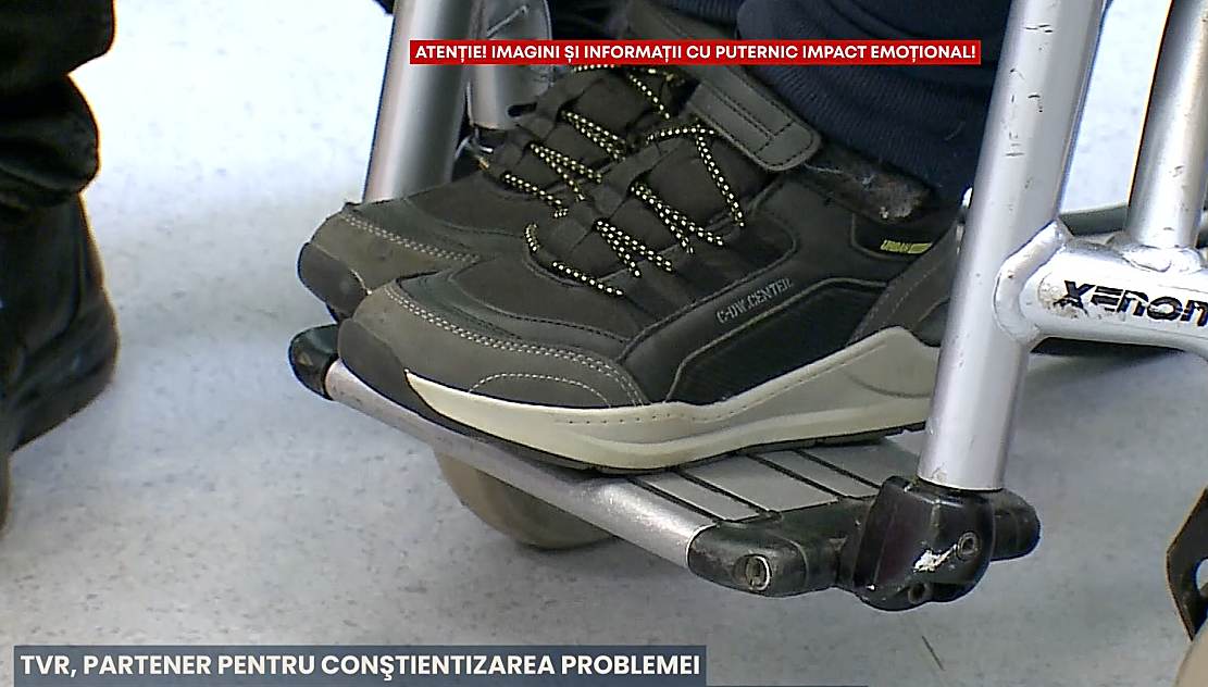 Boala Batten fură viitorul unor copii | Mai puţină