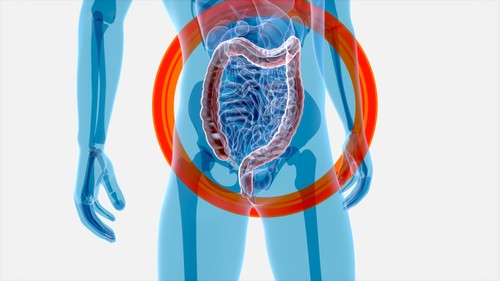 Microbiomul intestinal rămâne alterat mult timp după îndepărtarea unui polip